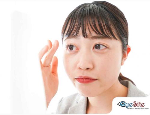 Contact Lens Discomfort: Causes and Remedies